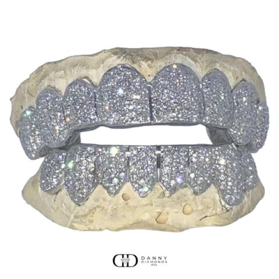 Custom Diamond Grillz Vs 